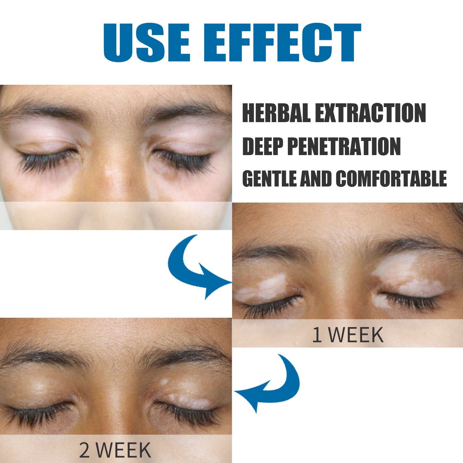 Nursing Efficacy On Skin Cream