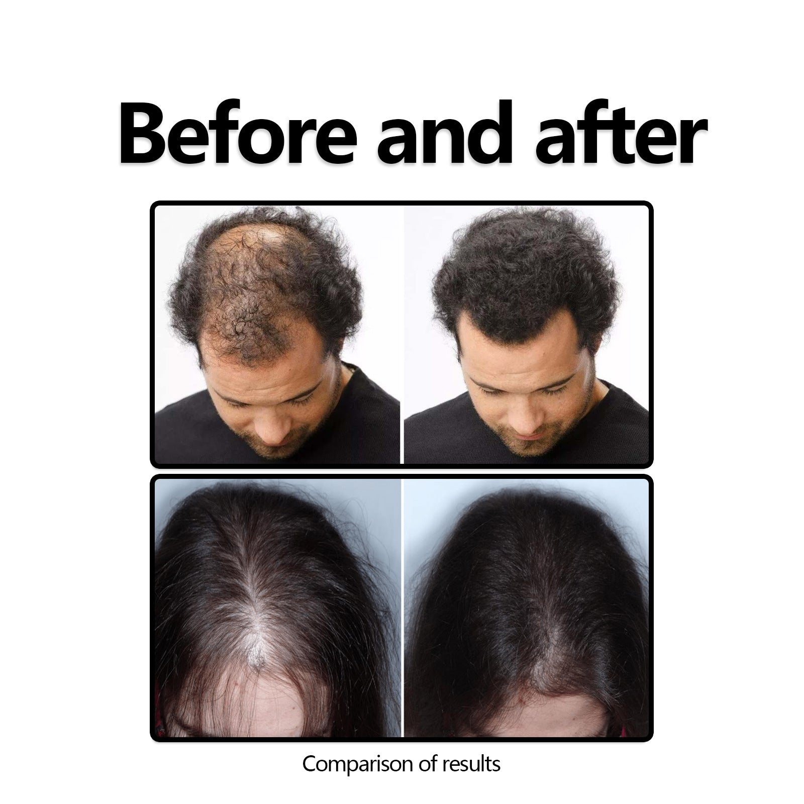 Eelhoe Herbal Hair Care Solution Anti-hair Loss And Strong