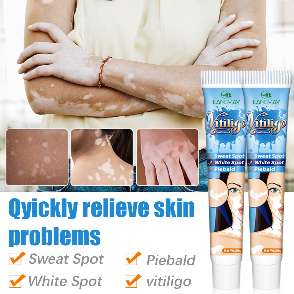 Vitiligo Sweat Spotted Skin Care Repair Cream