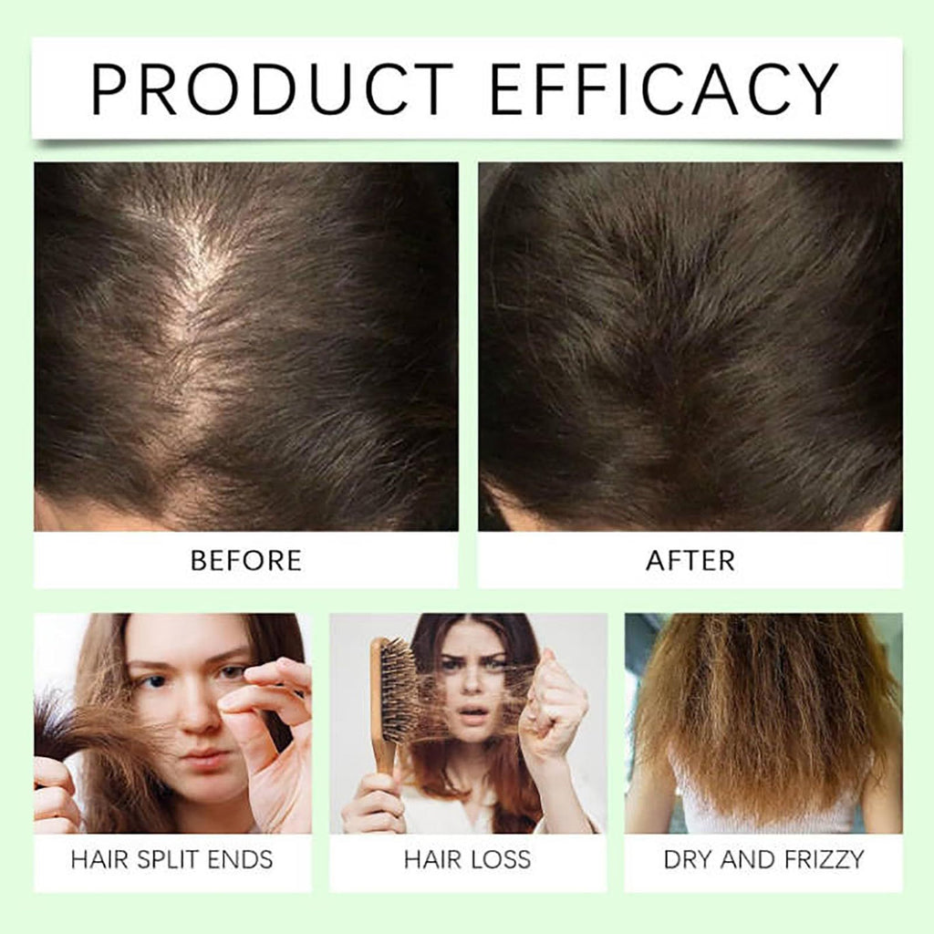 Anti-hair Loss Shampoo