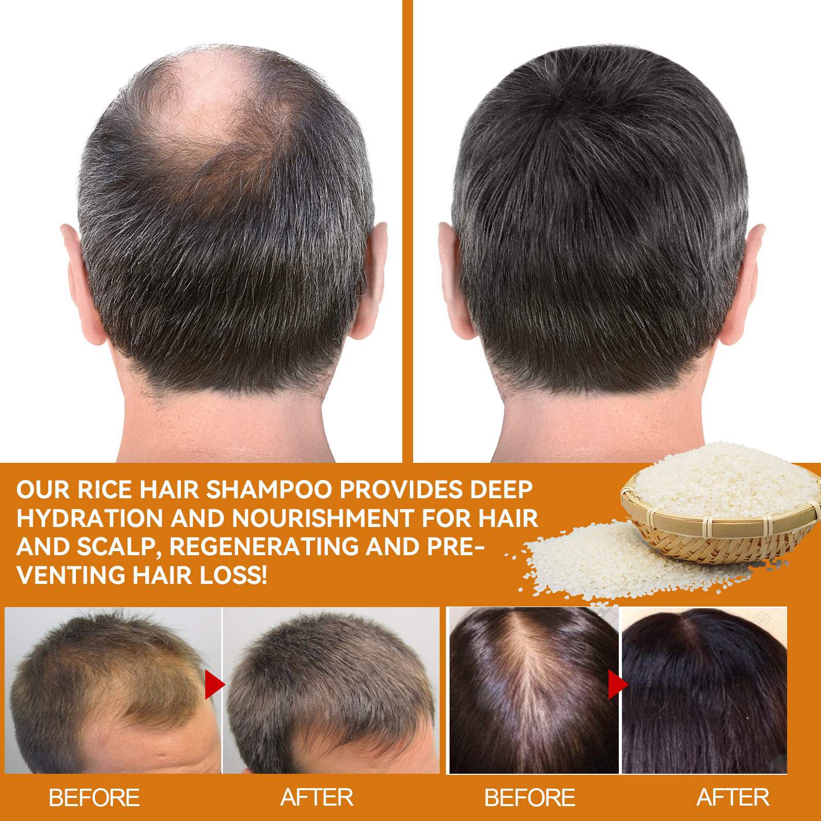 Eelhoe Rice Deep Cleaning Thick Conditioning Shampoo