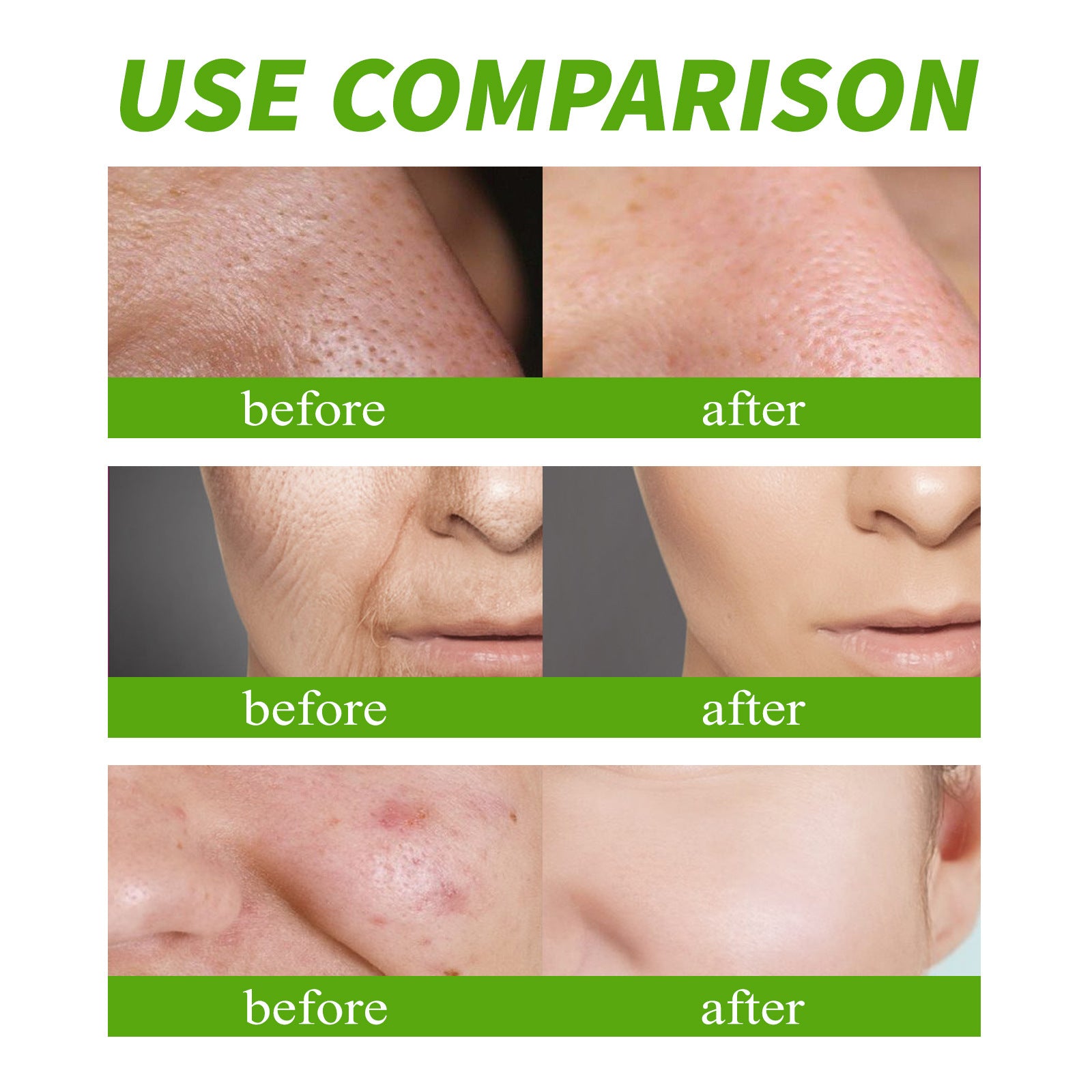 Facial Gel Cream Fade Spot Fine Lines