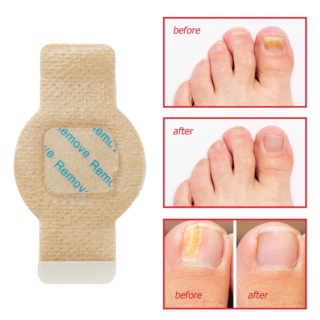 Elaimei Nail Antibacterial Patch Strengthening Health Patch