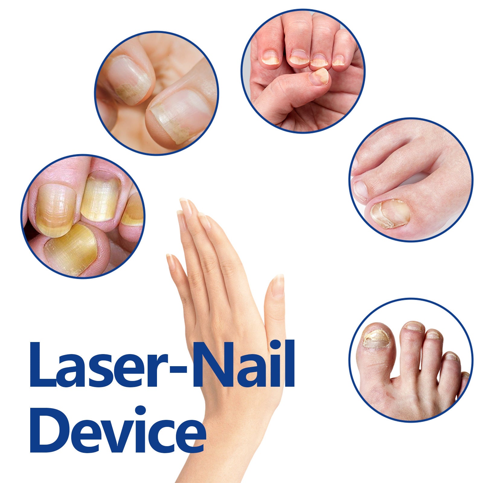 Eohoe Repair Soft Nail Care Phototherapy Device