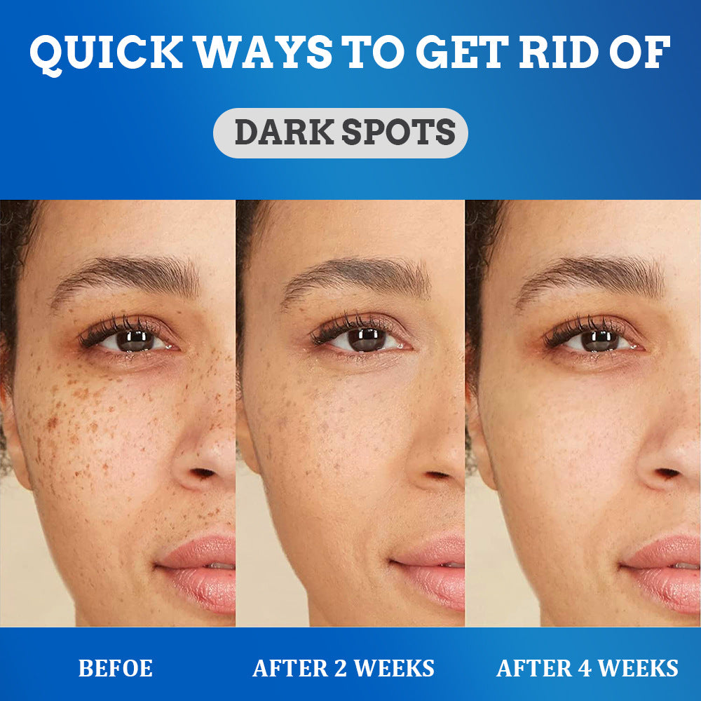 Fade Spot Cream Brightening White Moisturizing Cream