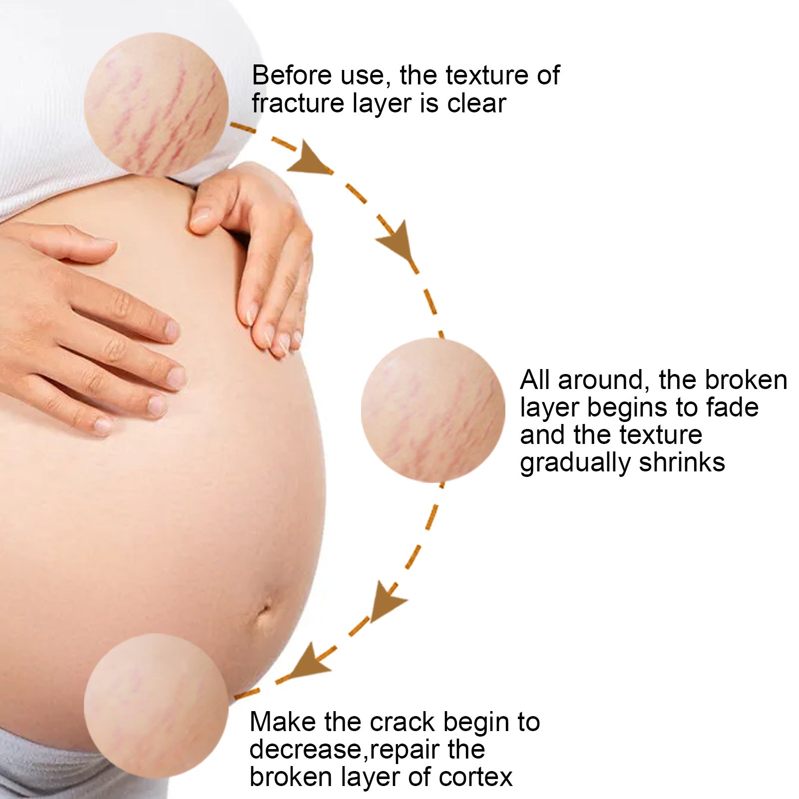 Fade Prevention Of Obesity Pregnancy Repair Cream