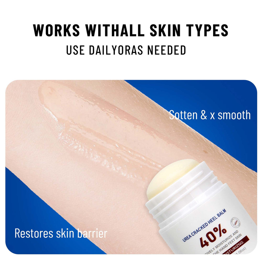 Cross-border Urea Cream 40 Heel Crack Repair Neck Cream