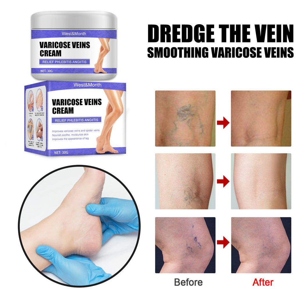 Vein Repair Cream Blue Vein Painful Legs