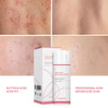 Cross-border Acne Cream For Buttocks Acne Cream For Foreign Trade Only Amazon