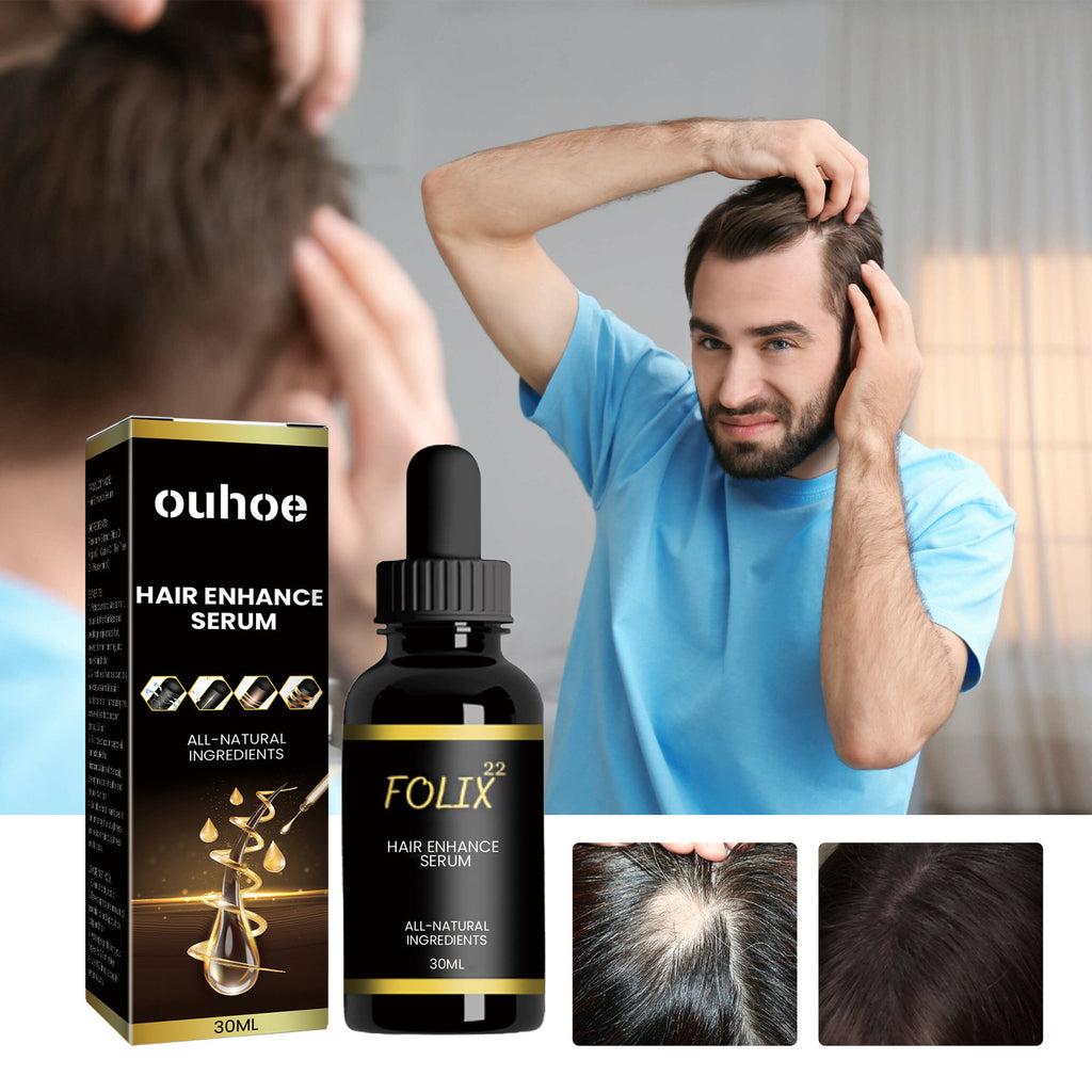 Ouhoe Dense Hair Essential Oil Moisturizes Hair Roots