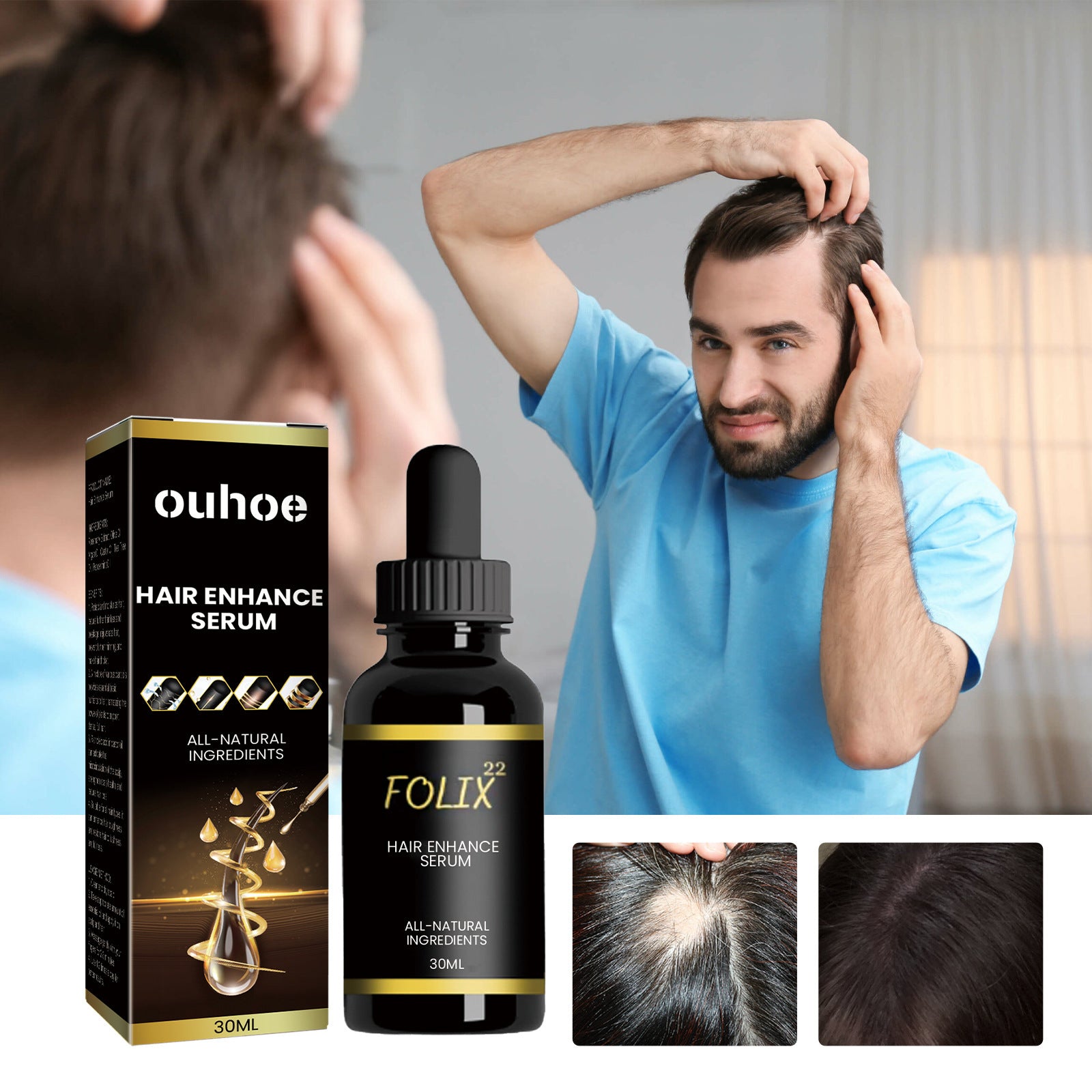 Ouhoe Dense Hair Essential Oil Moisturizes Hair Roots