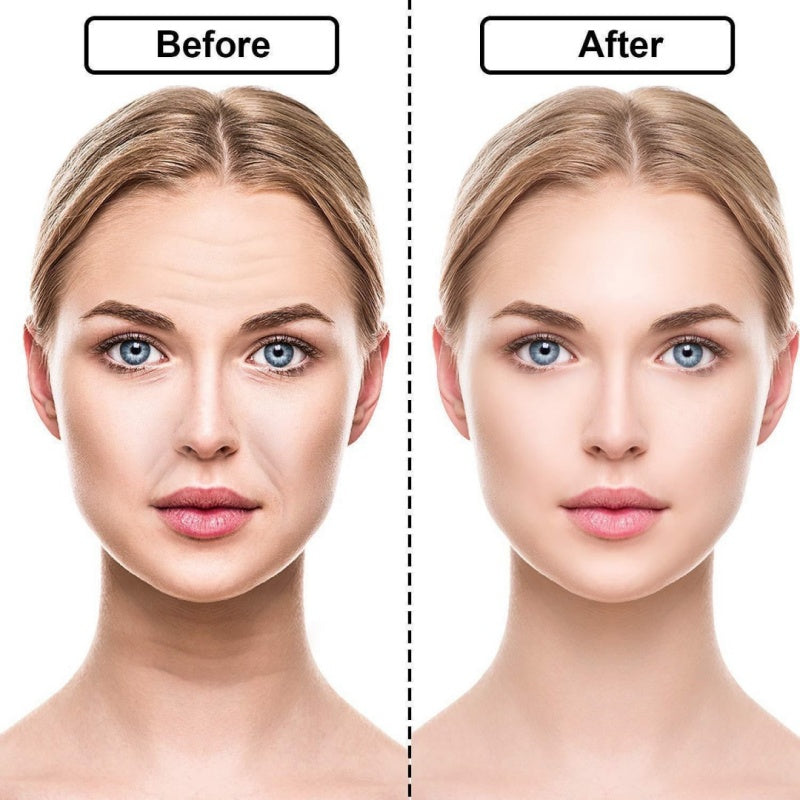 Silicone Anti-wrinkle Stickers