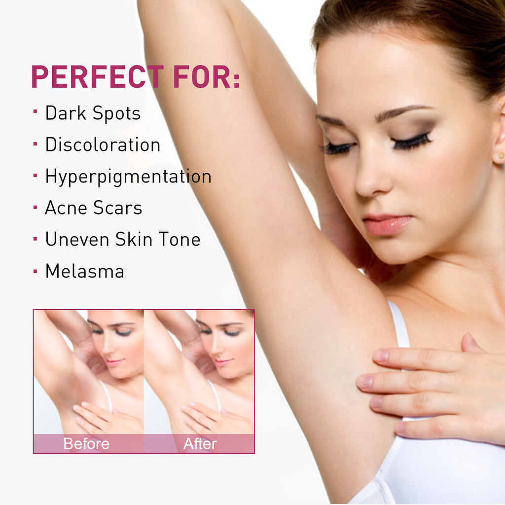 Underarm Melanin Nourishing Moisturizing Skin Rejuvenation Cream