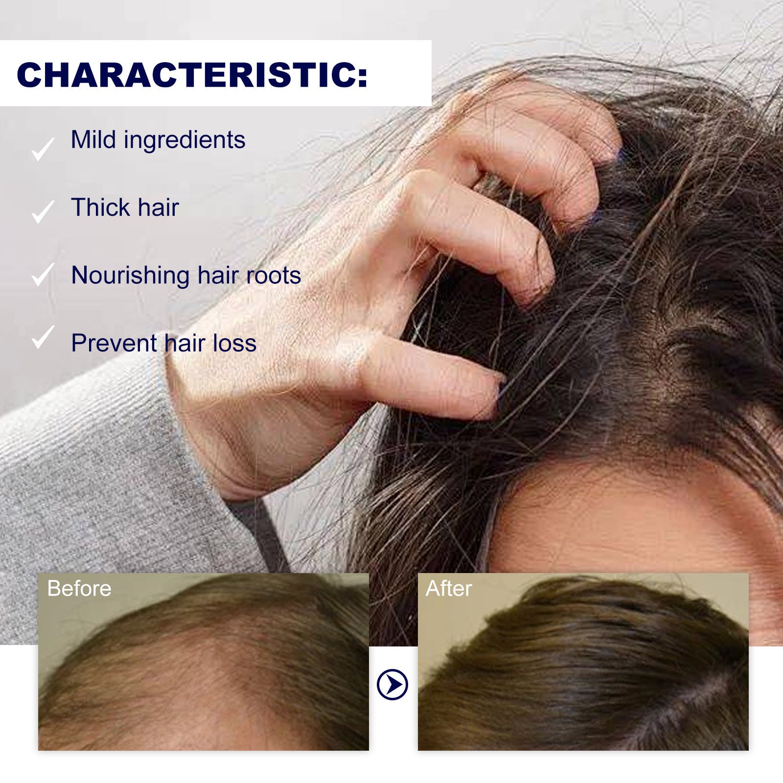 HoeGoa Hair Care Roller Repair Strong And Firm Hair Moisturizing Hair Root