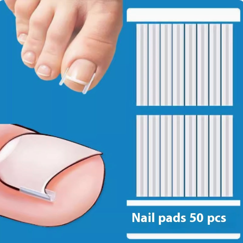 Special Nail Embedding Device For Correcting Paronychia