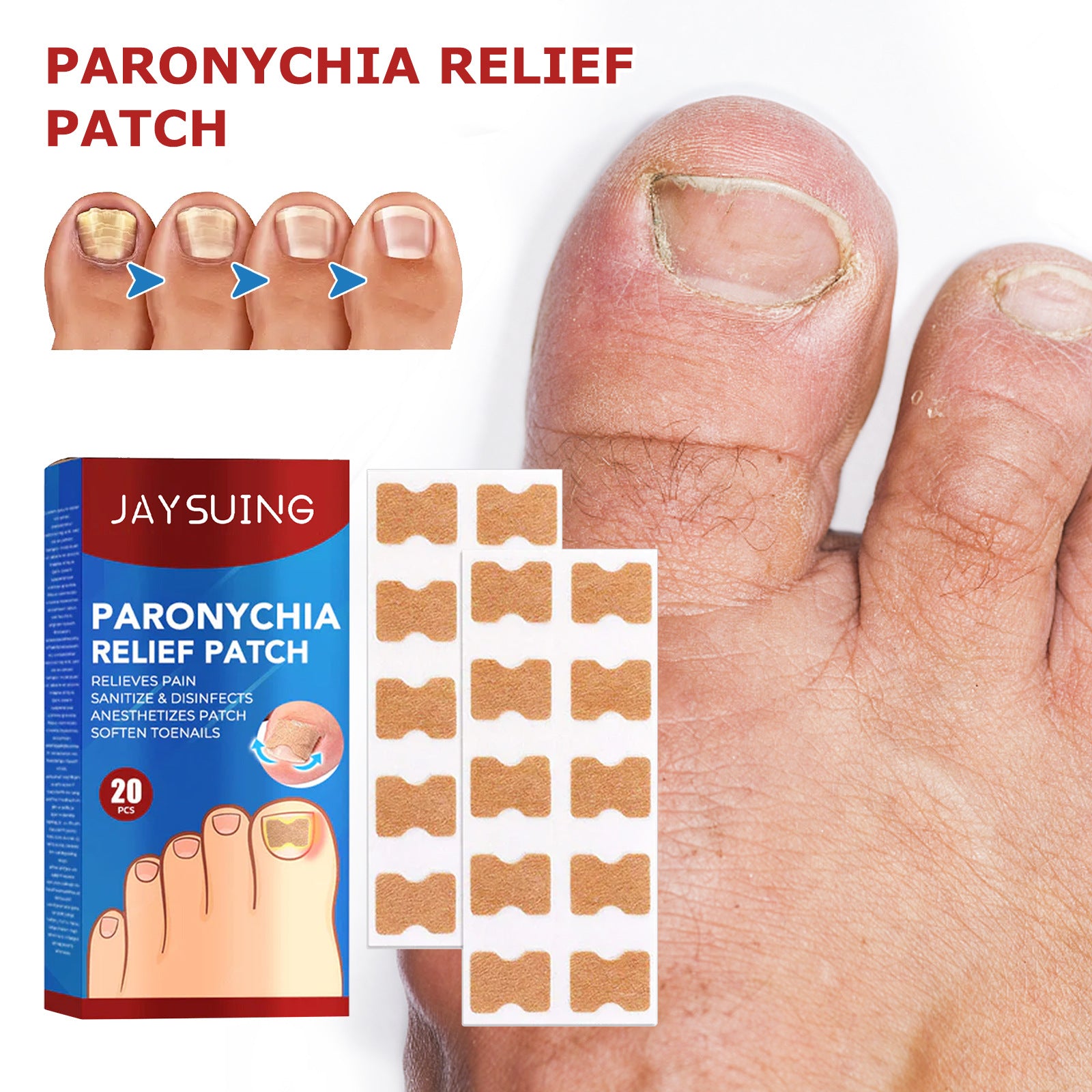 Jaysuing Nail Groove Nursing Adhesive Bandage Repair Thickened Gray Nail Soft Nail Correction