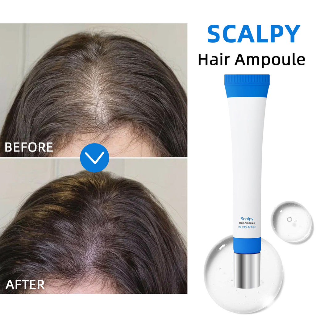 Scalpy Non-standard Hair Growth Strong Hair Root Dense Hair Fixing Liquid
