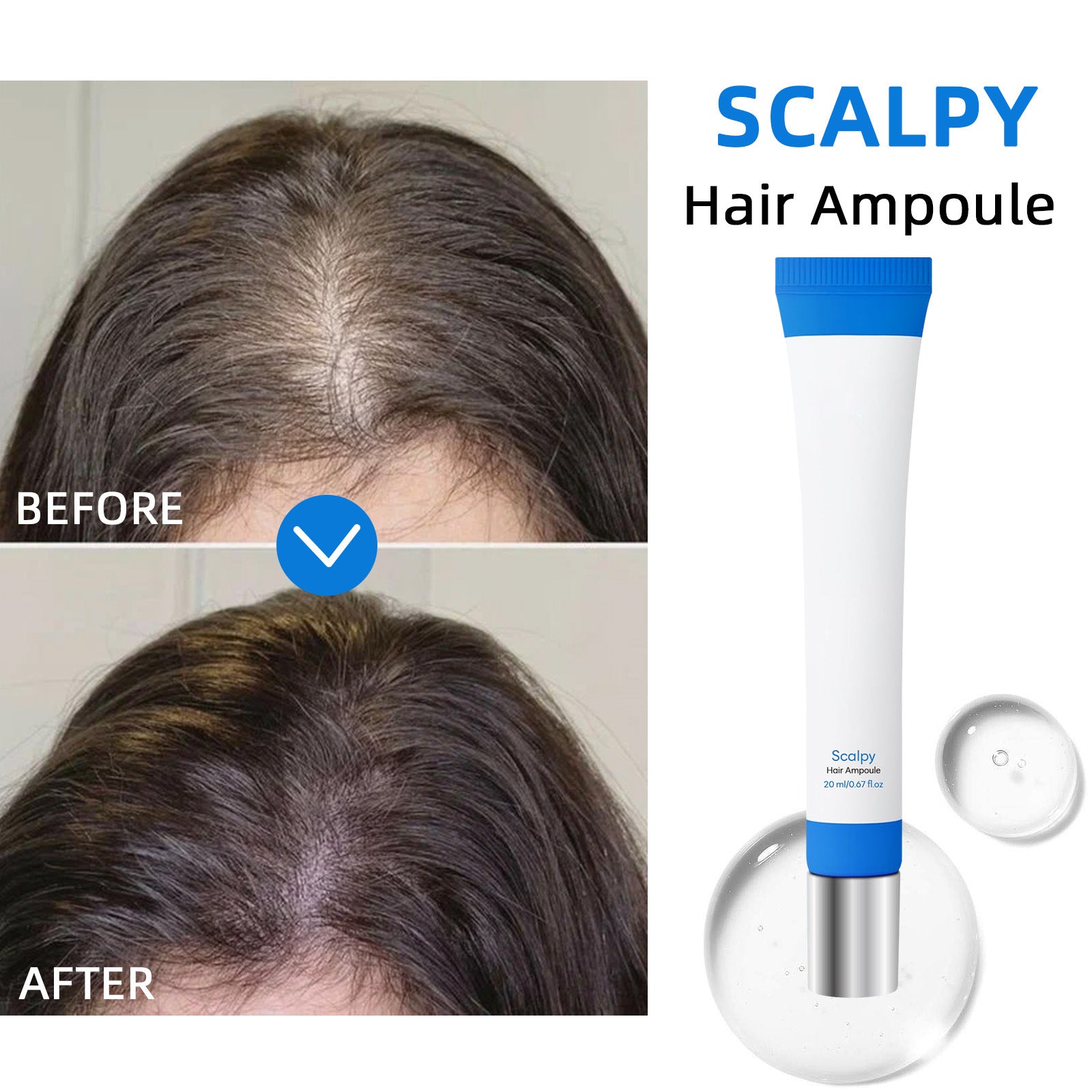 Scalpy Non-standard Hair Growth Strong Hair Root Dense Hair Fixing Liquid