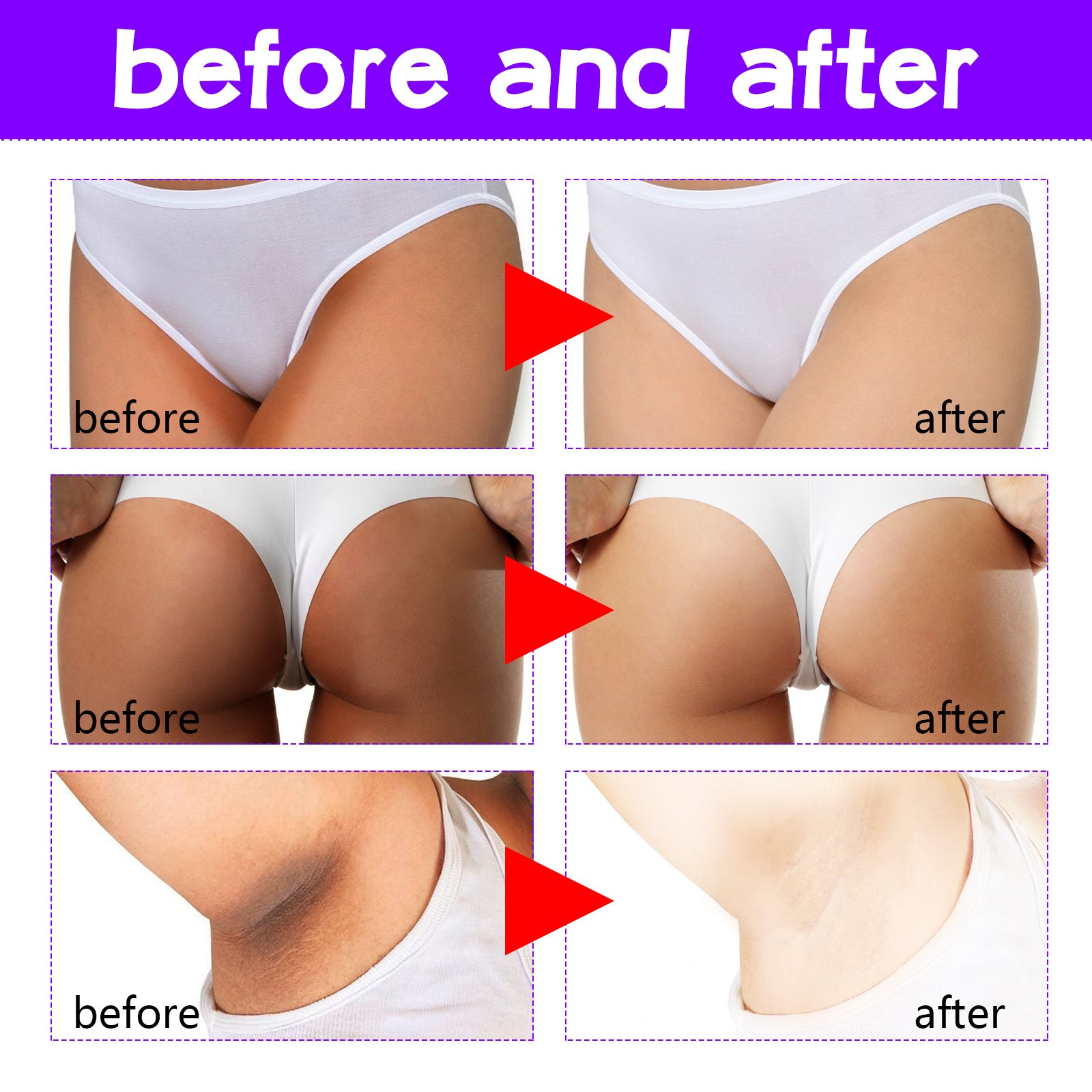 Inner Thigh Skin Cream Whitening