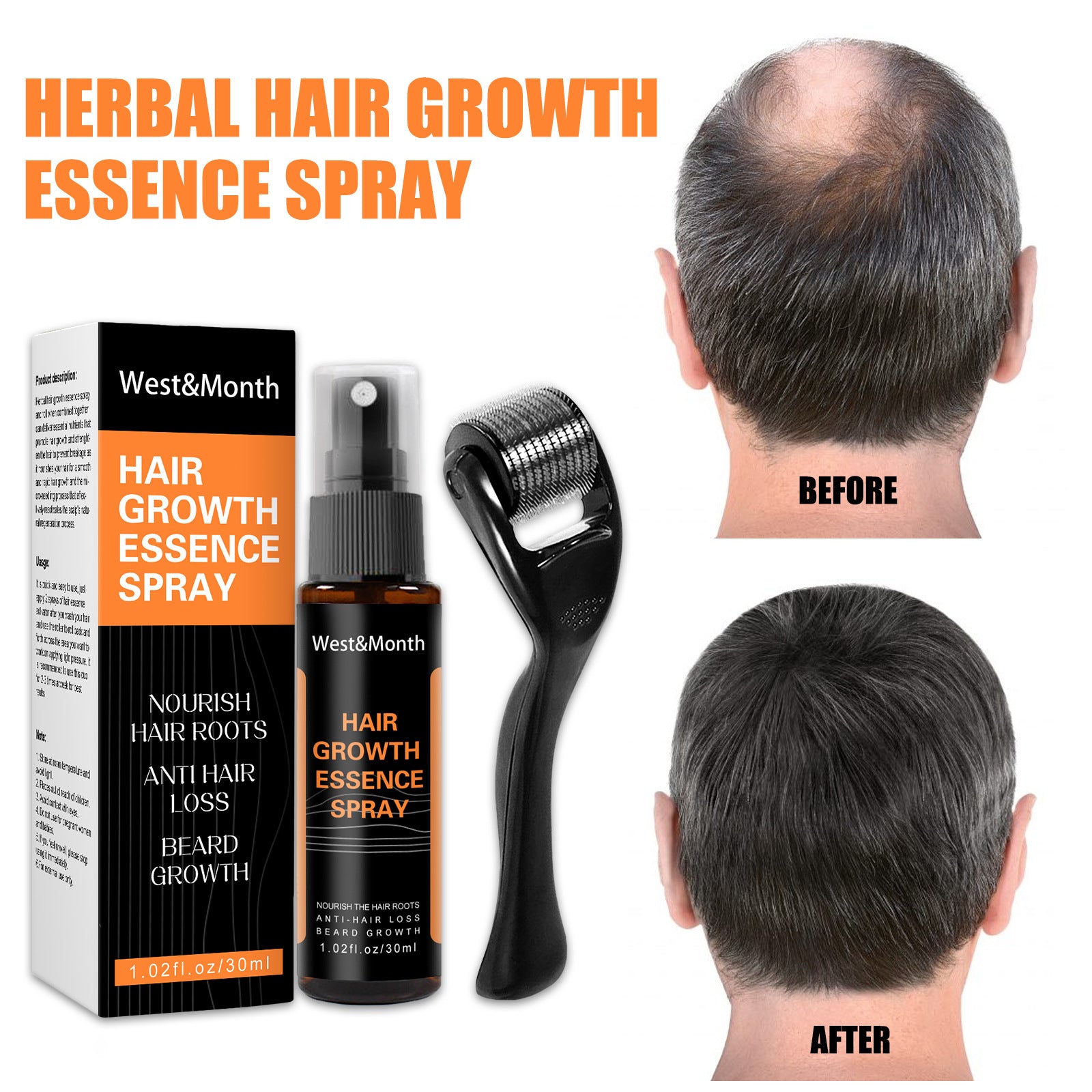 West&Month Hair Growth Spray Anti-hair Nourishing Growth Liquid