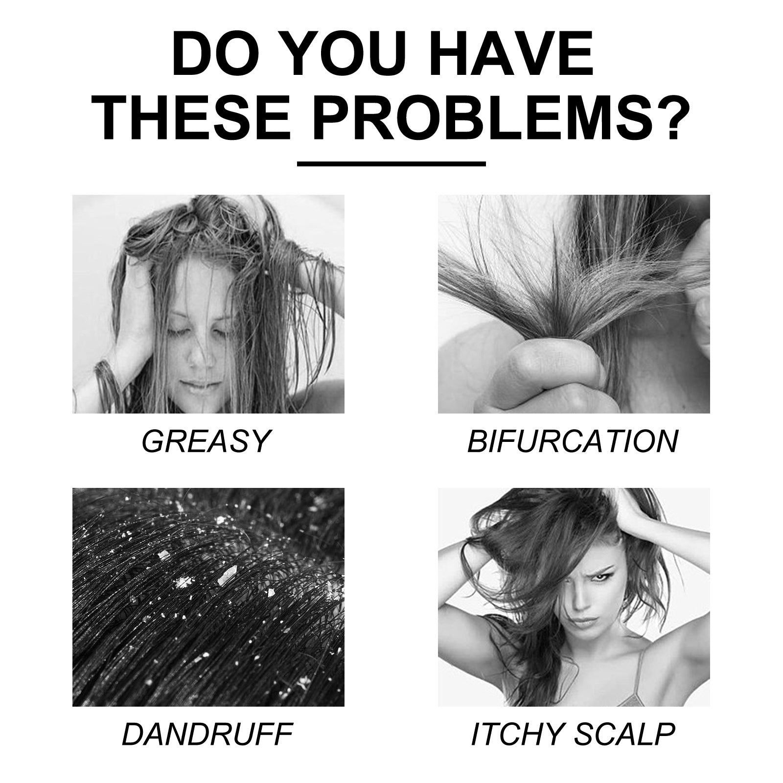 Jaysuing Cleansing Scalp Dandruff Soft Fluffy Shampoo