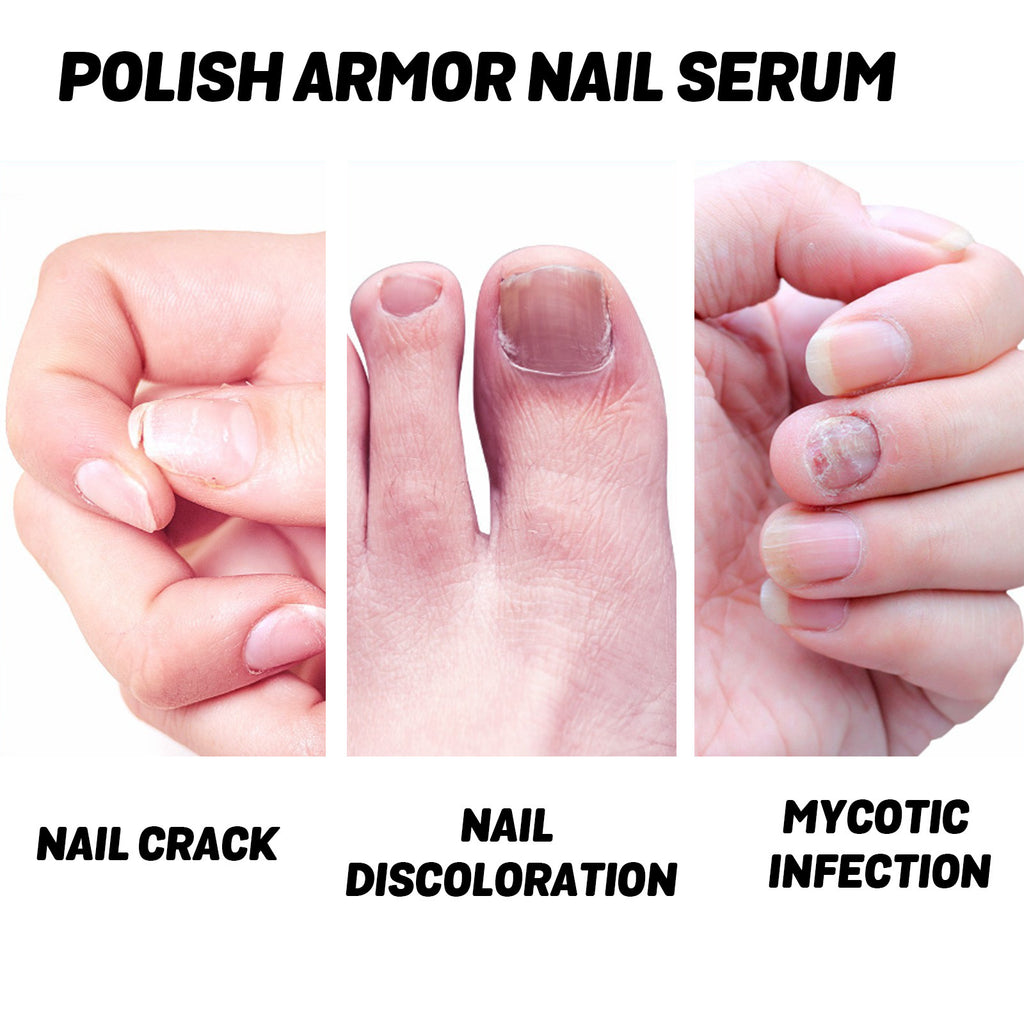Nursing Nourishing Nail Saver Beauty