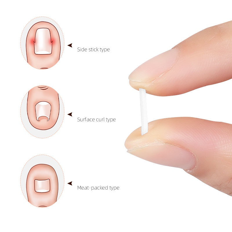 Filler Nail Pad Plaster Nail Silk Brace