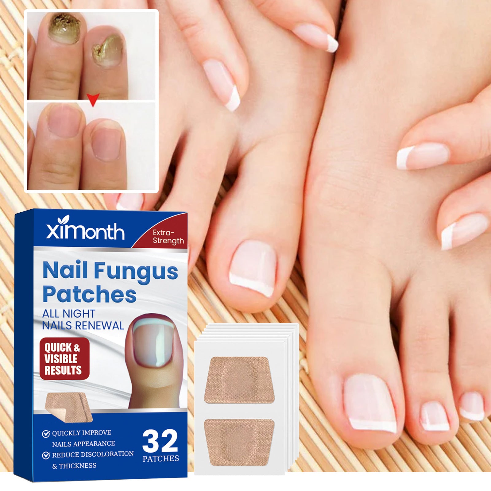 Ximonth Nail Nursing Adhesive Bandage Repair