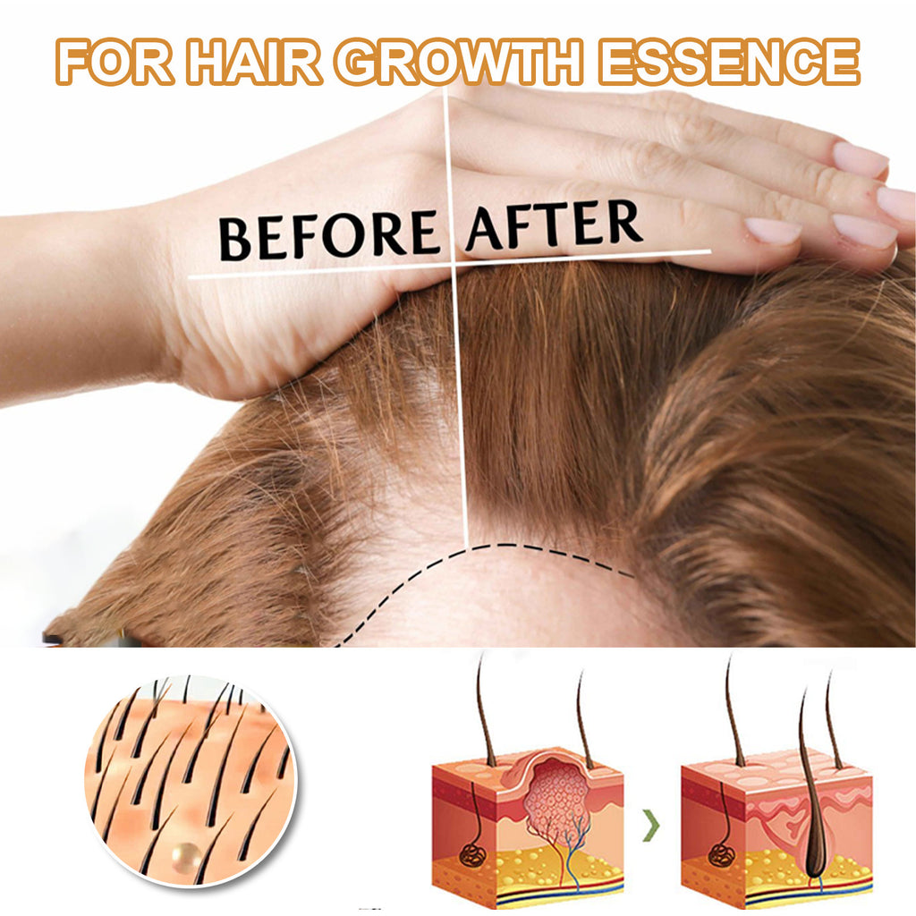 Rice Water Hair Essential Oil Improves Dry Hair And Manic Hair Moisturizing Serum