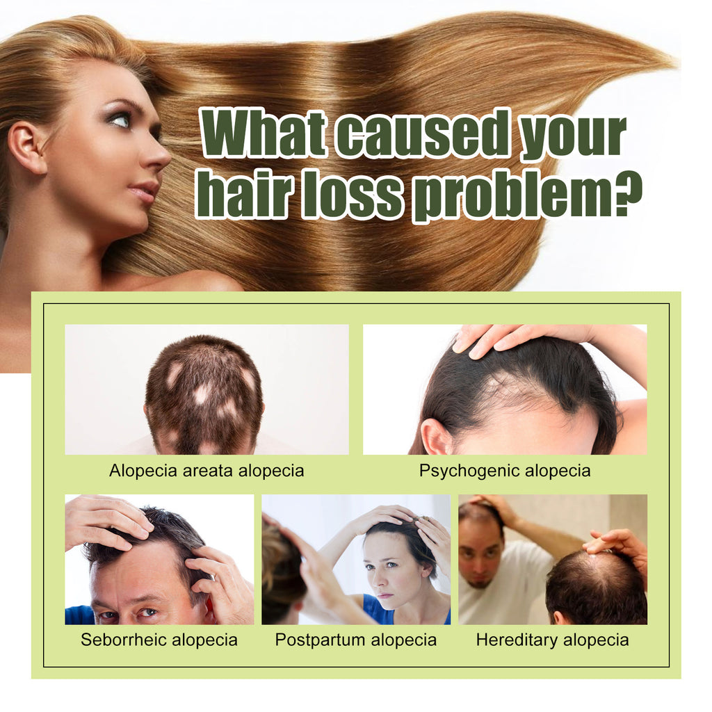 South Moon Hair Care Anti-fall Repair Hair Tail Dry And Manic Hair Soft And Moisturizing Dense Hair Oil