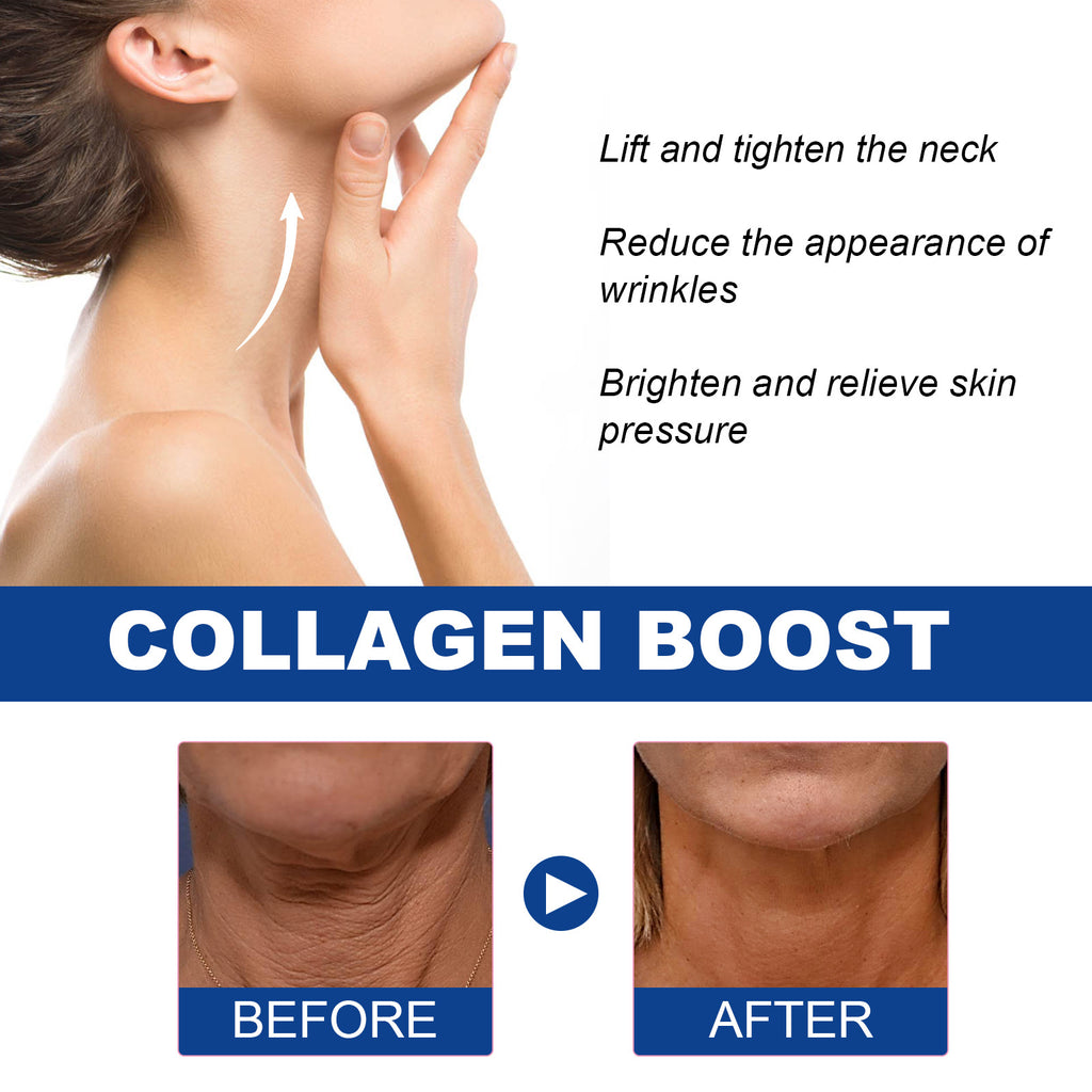 Neck Collagen Whitening Cream Reduces Neck Lines