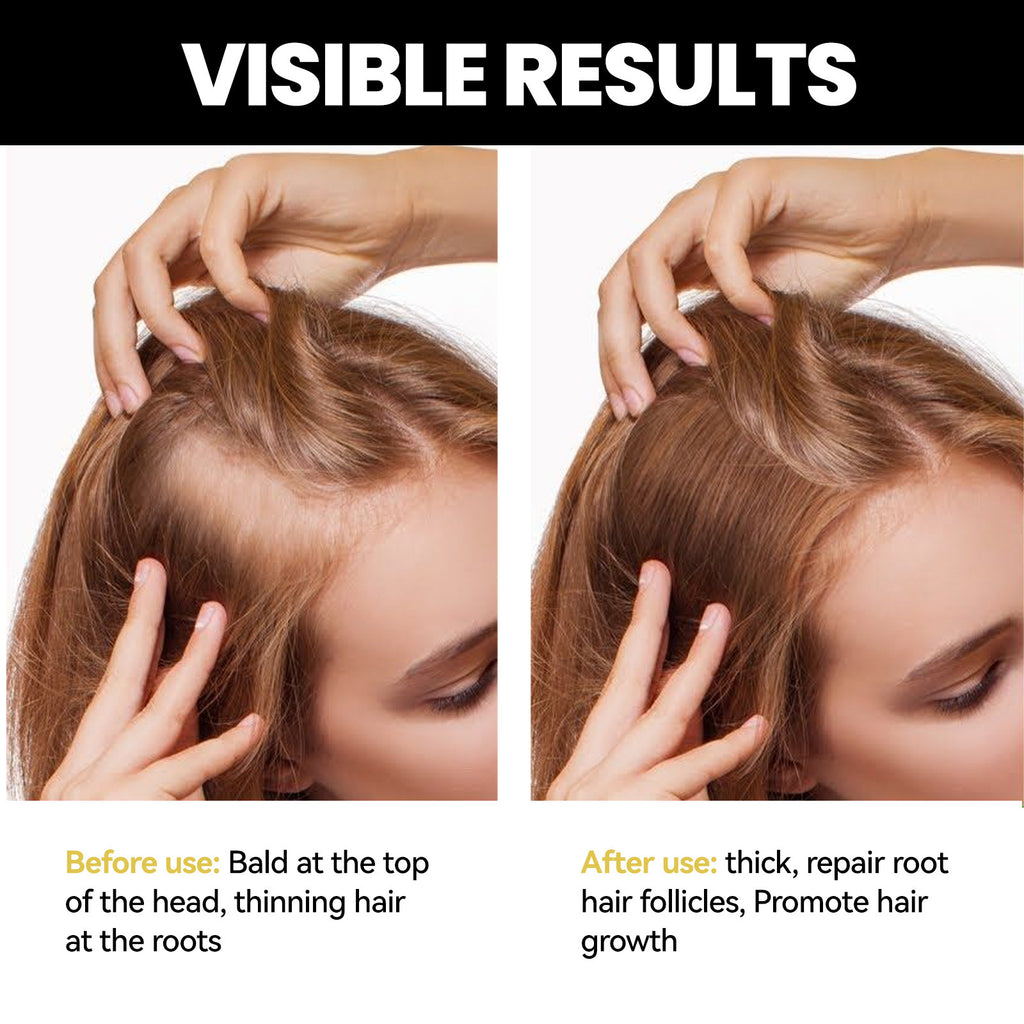 Ouhoe Dense Hair Essential Oil Moisturizes Hair Roots