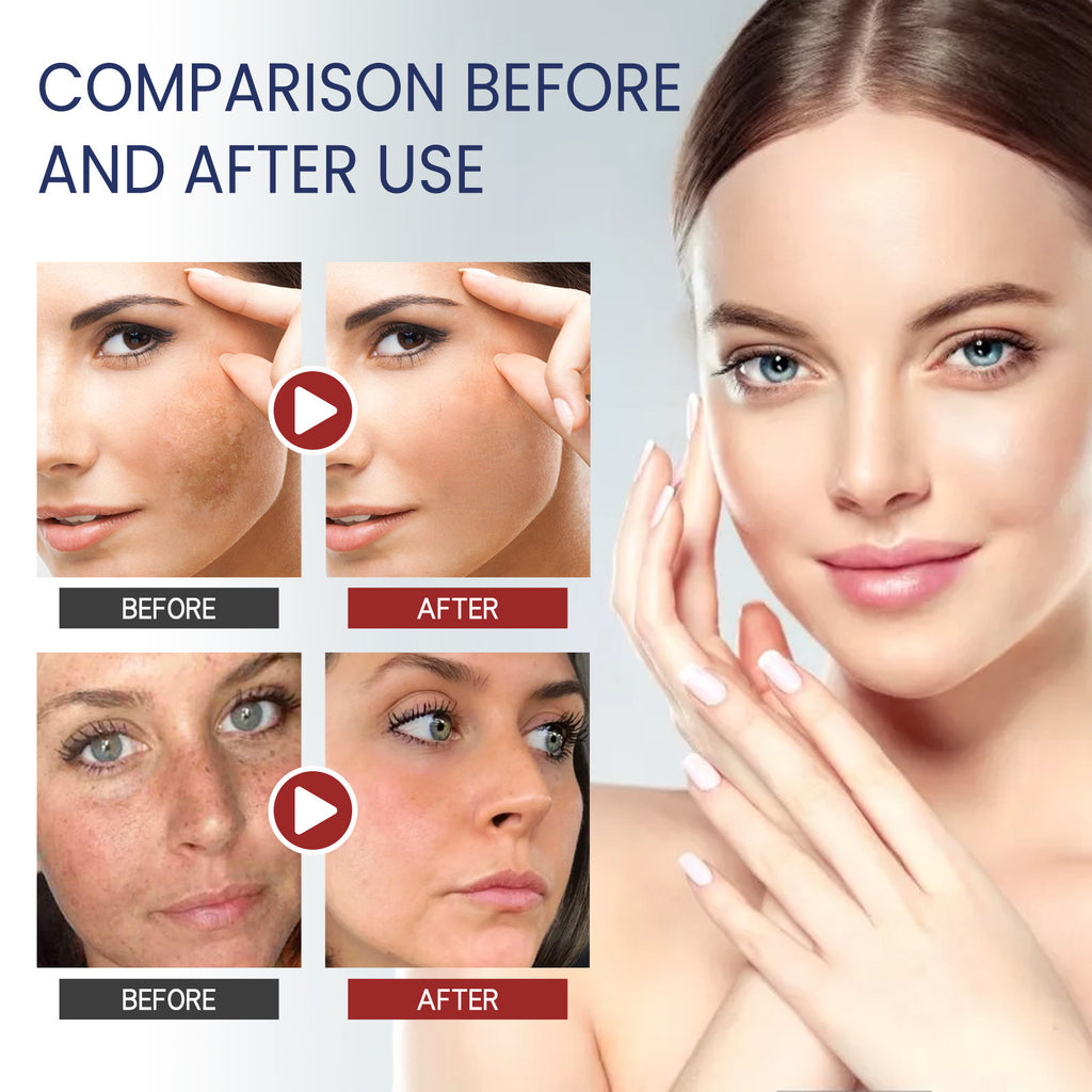 Fade Spots Softening Skin Moisturizing Cream