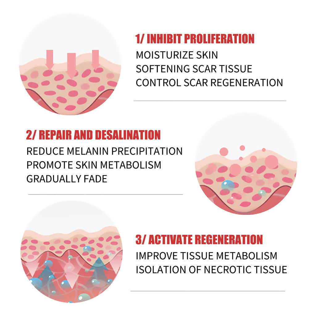 Scar Repair Cream Desalinates Old Scald Burns
