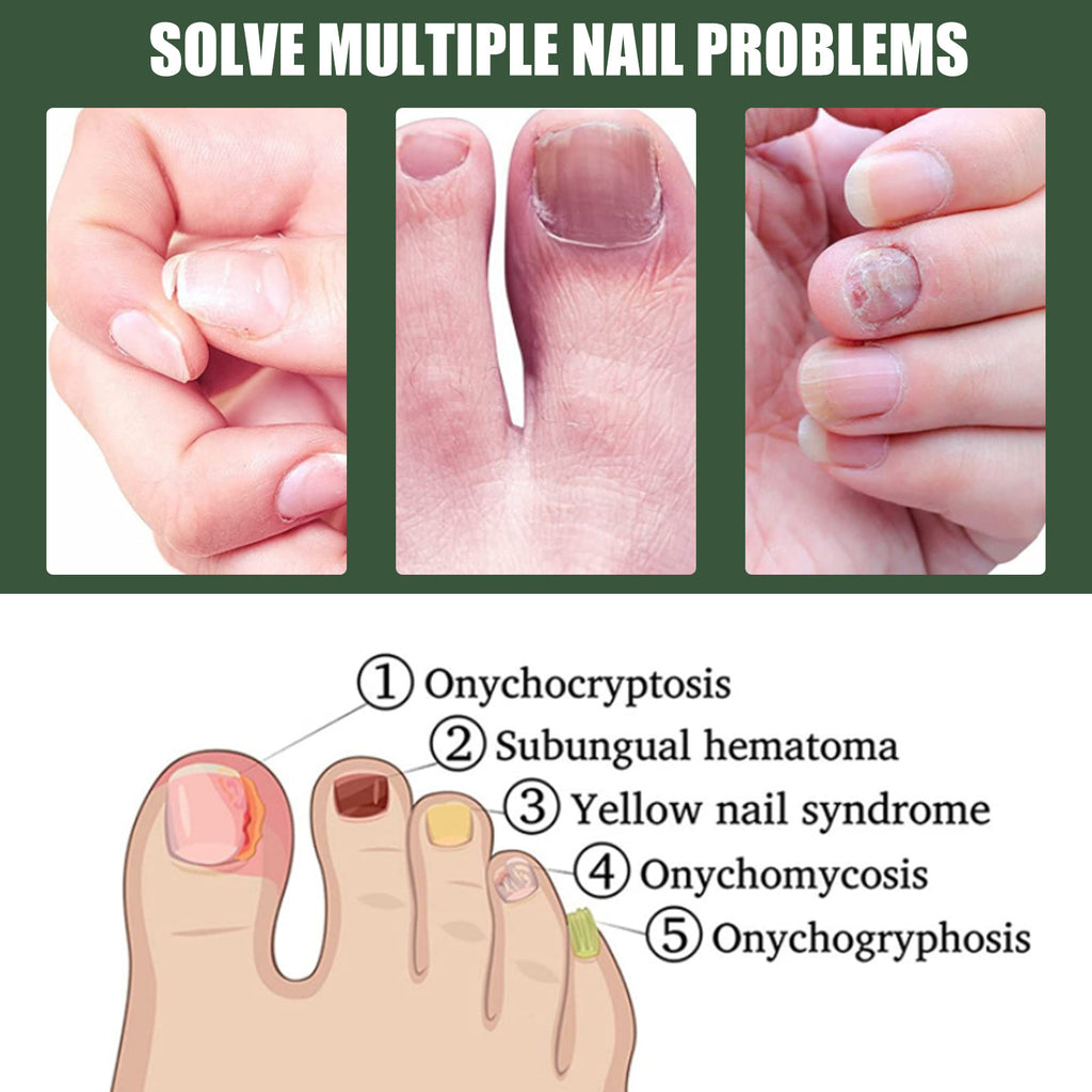 South Moon Nail Cleaning And Nail Repair Suit