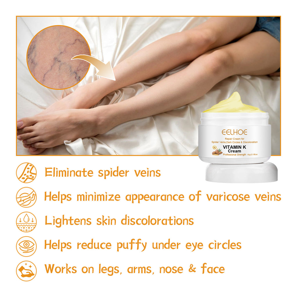 Bulge And Swelling Of Legs Repair Cream