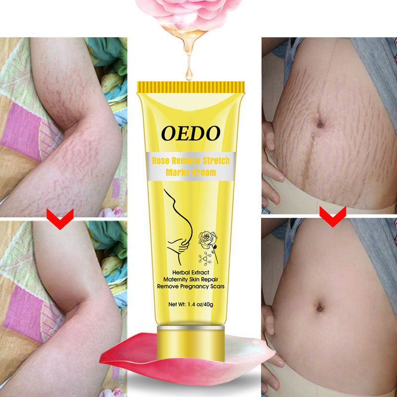 Rose go to stretch marks cream