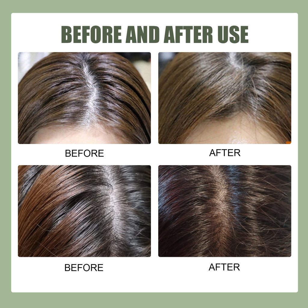 Centella Asiatica Sea Salt Shampoo Oil Dandruff Scalp Care