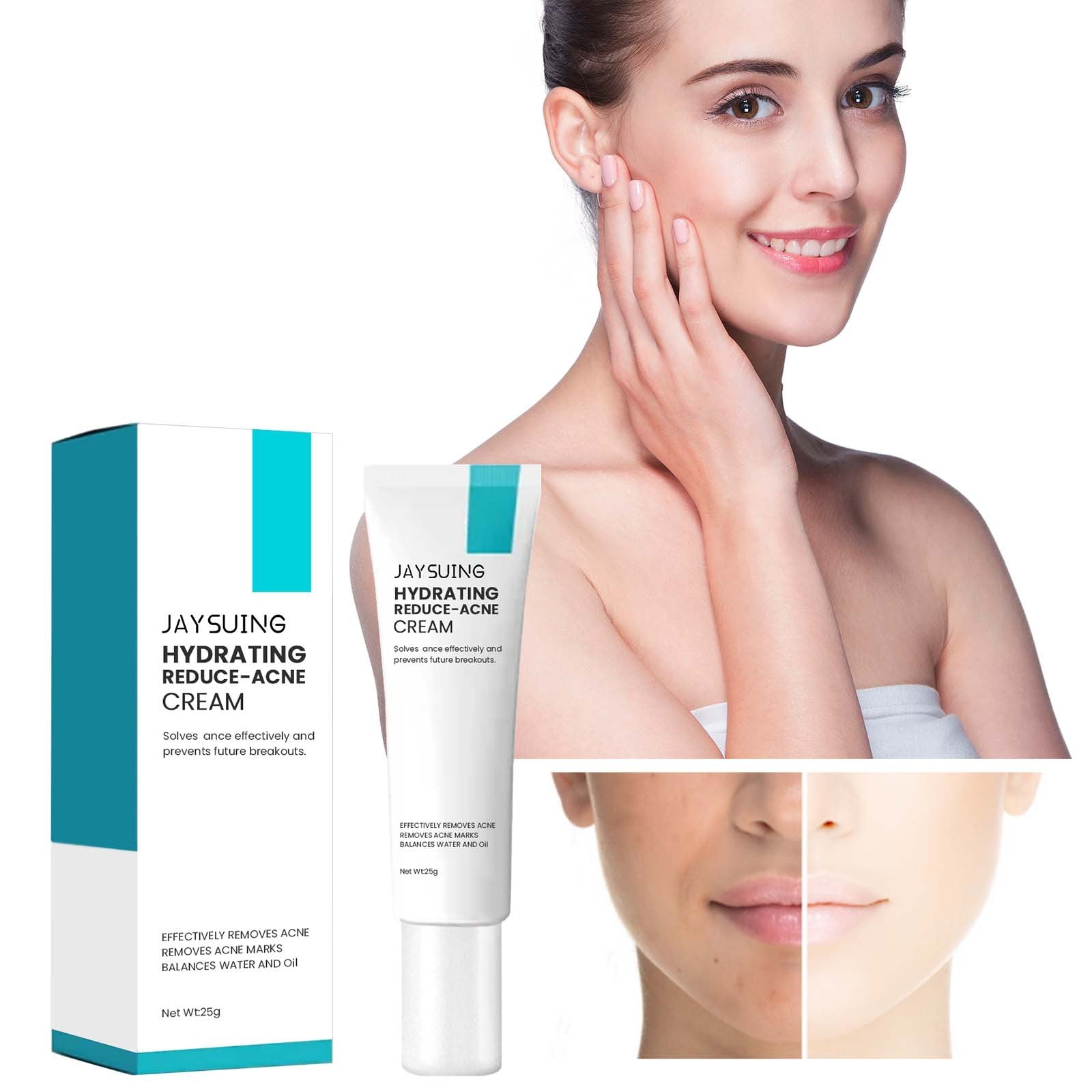 Desalting Pimple Moisturizing Delicate Skin Lightening Cream