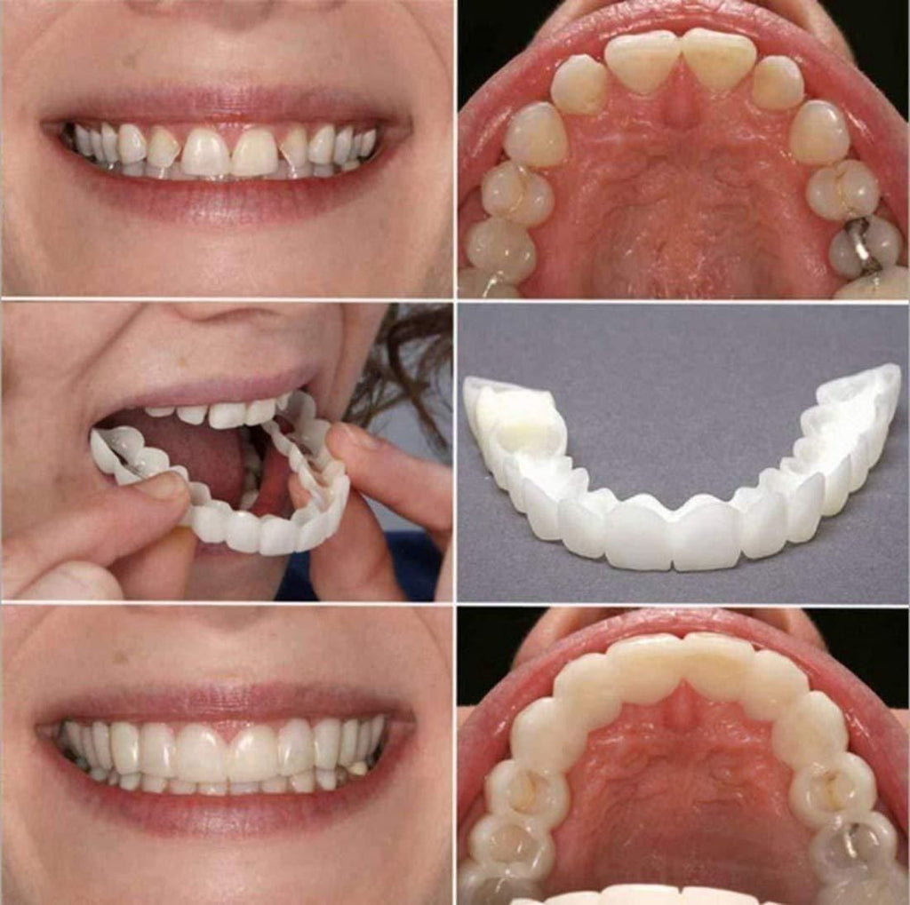 Instant And Confident On Smile Fit Flex Cosmetic Teeth Denture Teeth