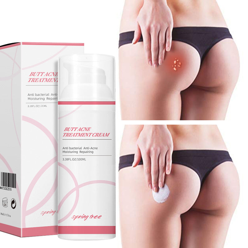 Cross-border Acne Cream For Buttocks Acne Cream For Foreign Trade Only Amazon