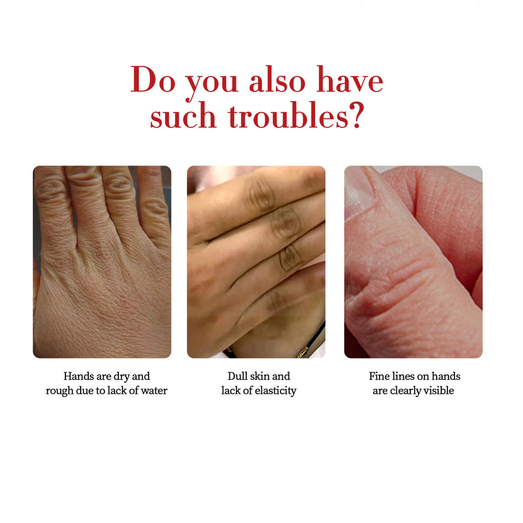Kojic Acid Hand Cream Moisturizing White