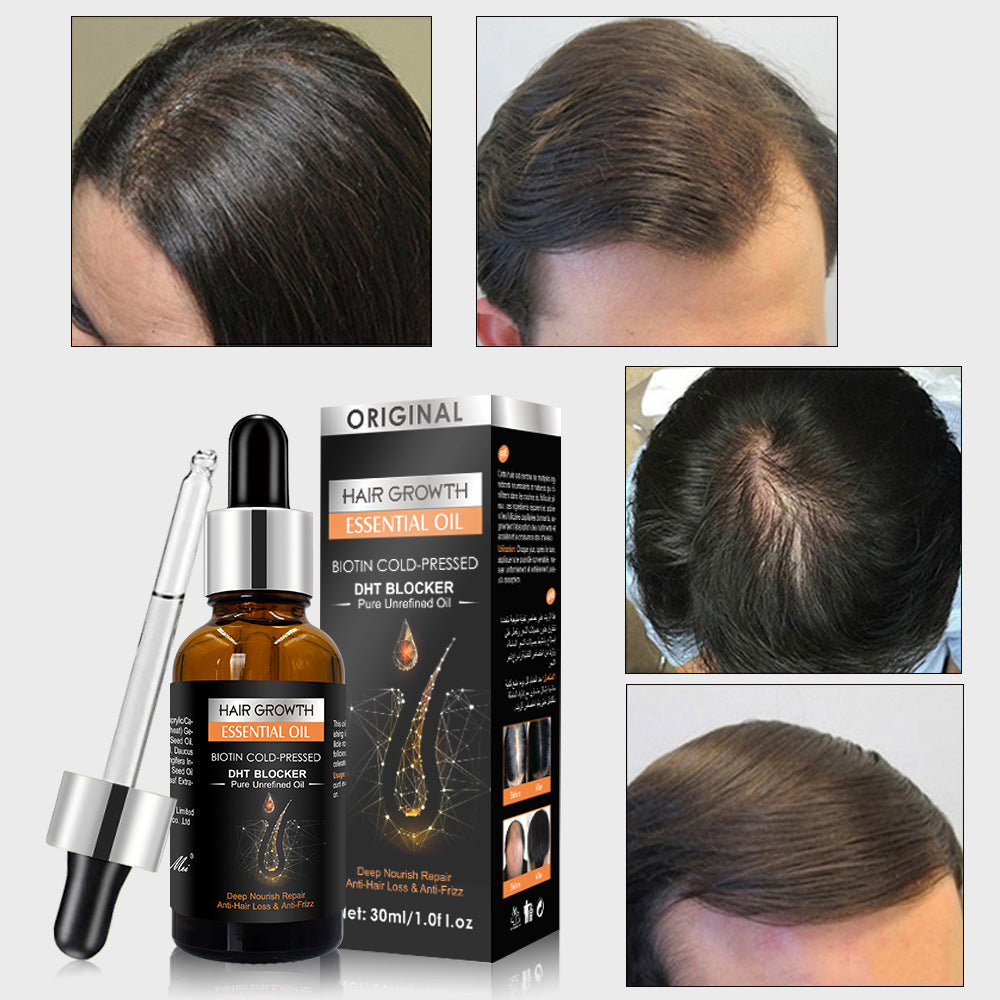 New Type Clean Dandruff Hair Growth Essential Oil Ginger Shampoo