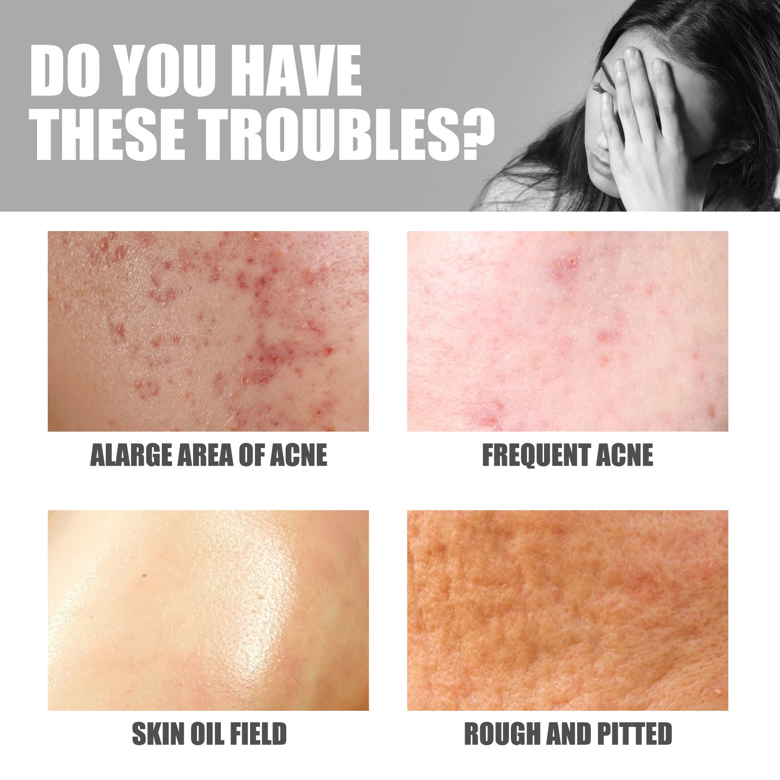 Hip Neck Cream Moisturizing Smallpox Diluting