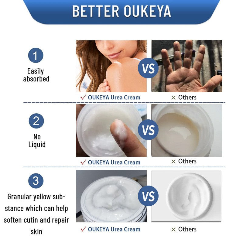 Tunmate Urea Cream 150g