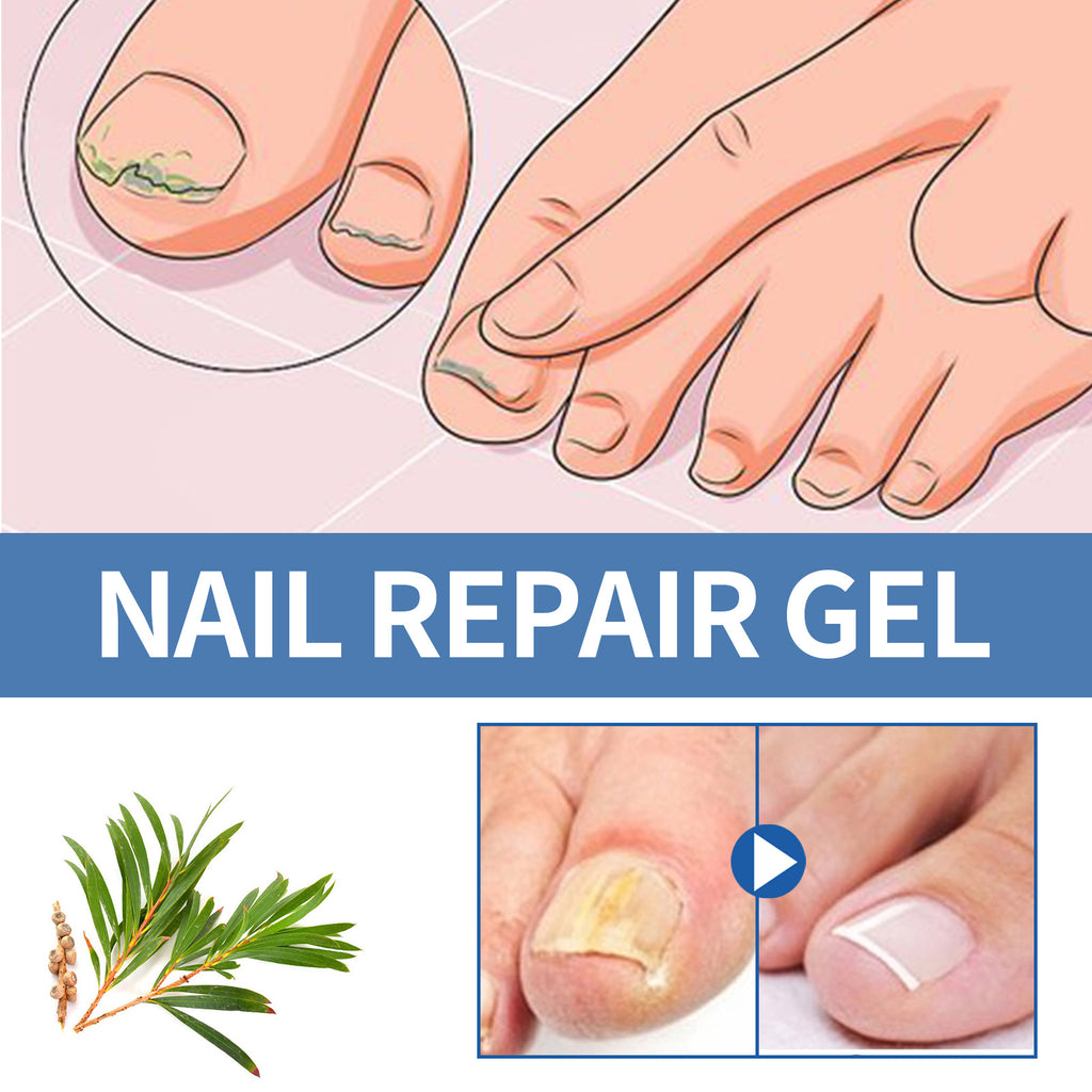 Ouhoe Nail Fungus Care Gel Repair