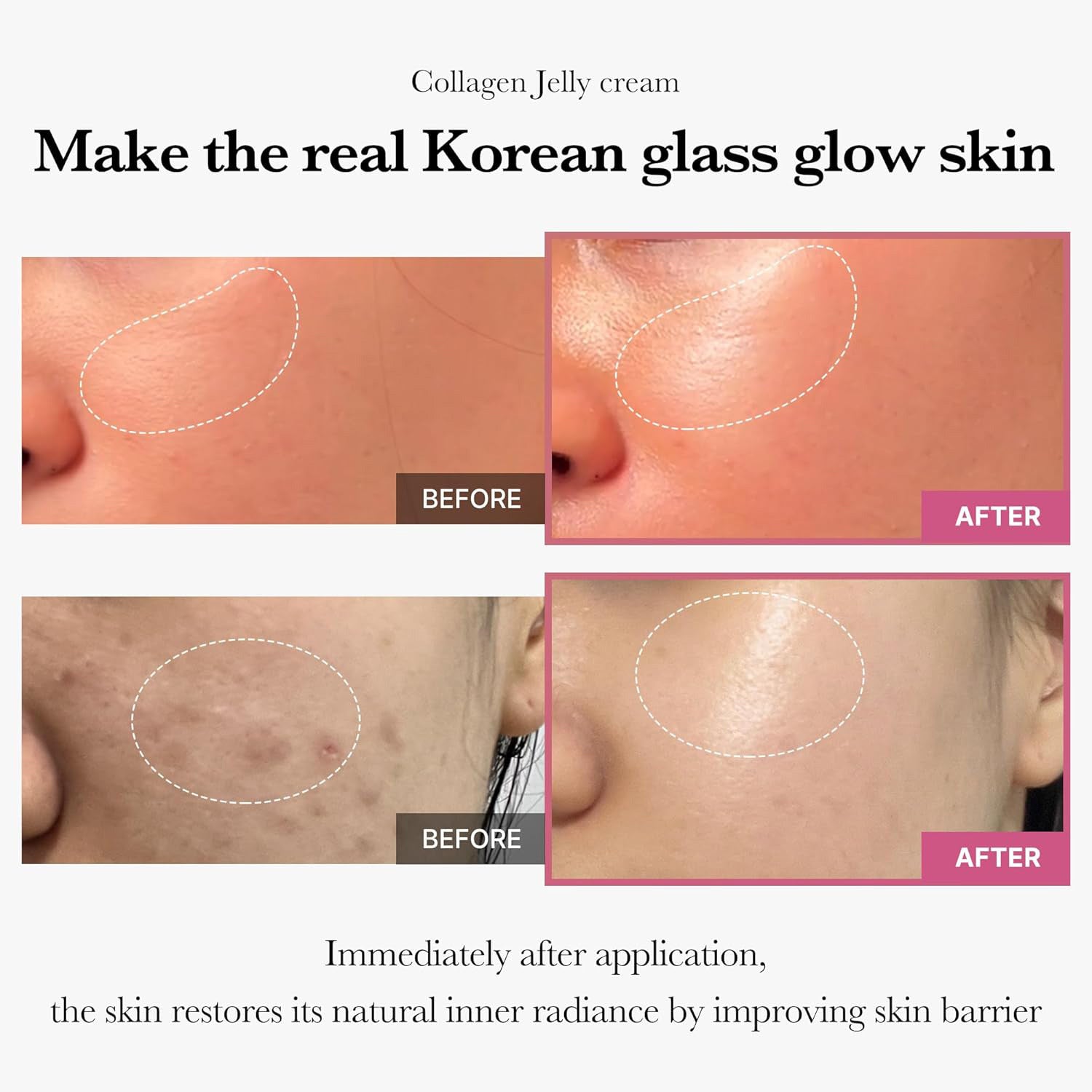 Collagen Jelly Cream Hydrating And Moisturizing