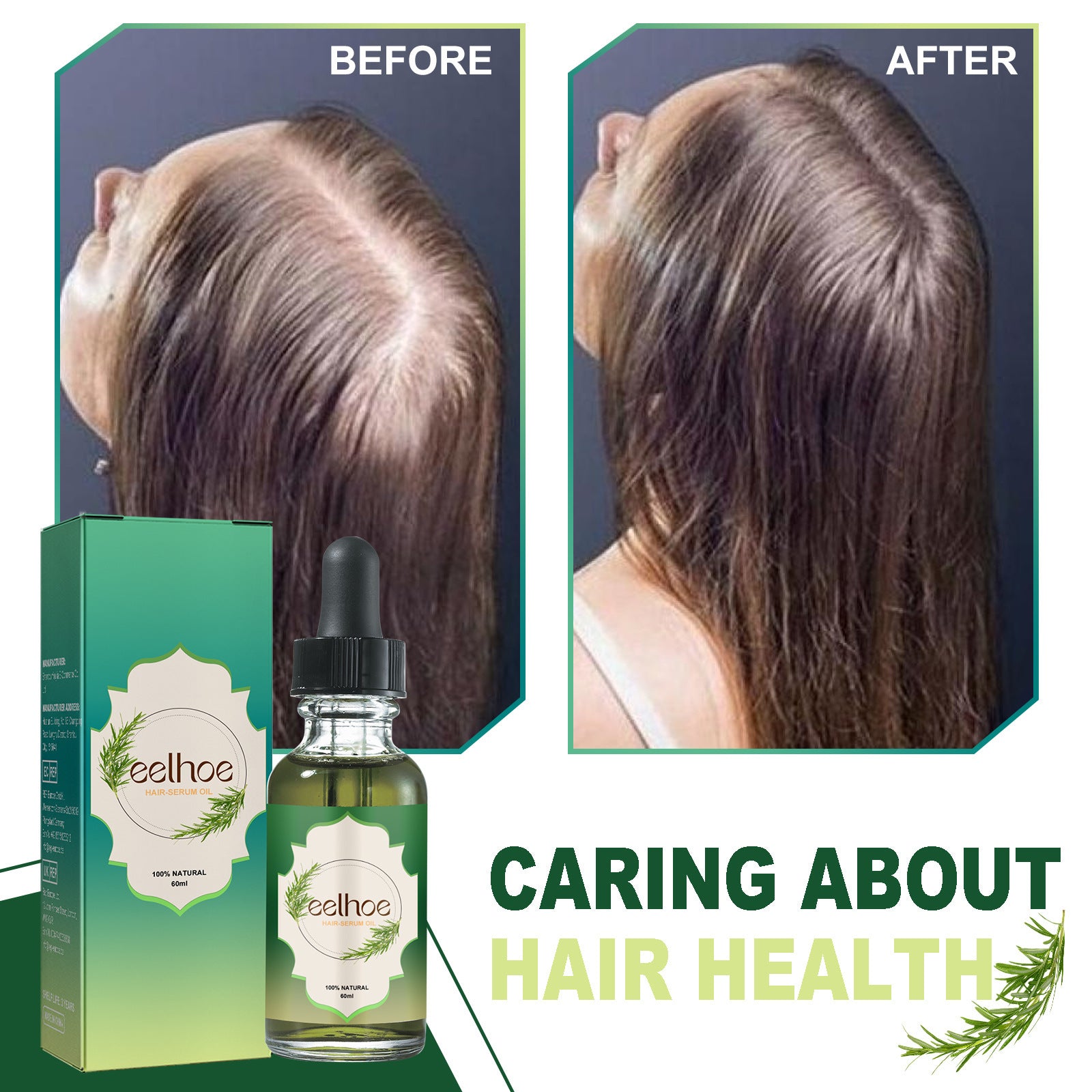 Eelhoe Nourishing Anti-hair Loss Thick Hair Care