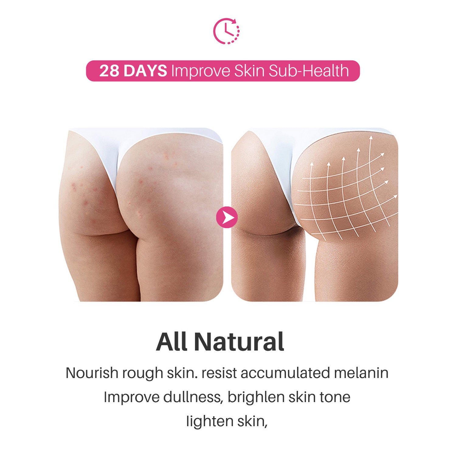 Hip And Leg Acne Cream Moisturizing
