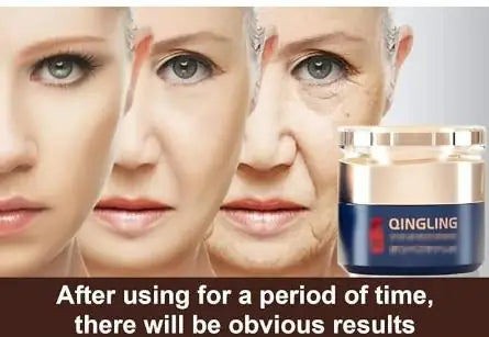 Wrinkle Removal Cream Retinol Anti Aging Nourishing Care Cream 100Gram